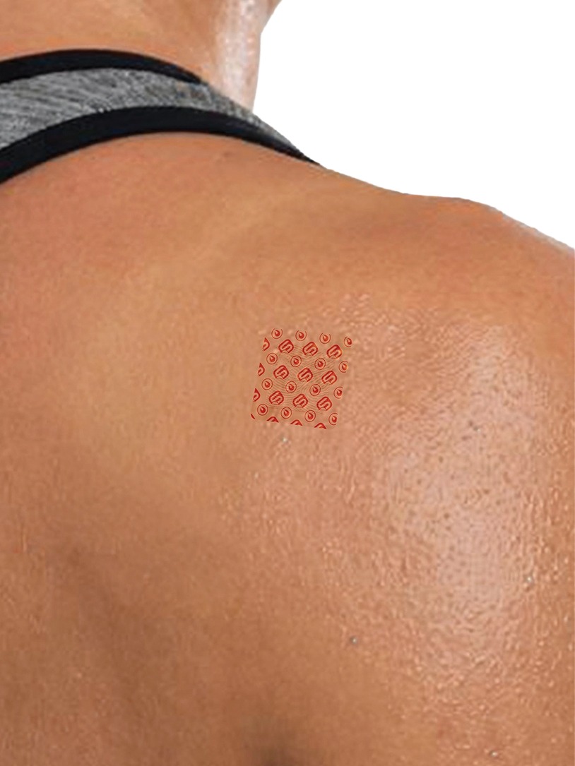 Parte superior de la espalda