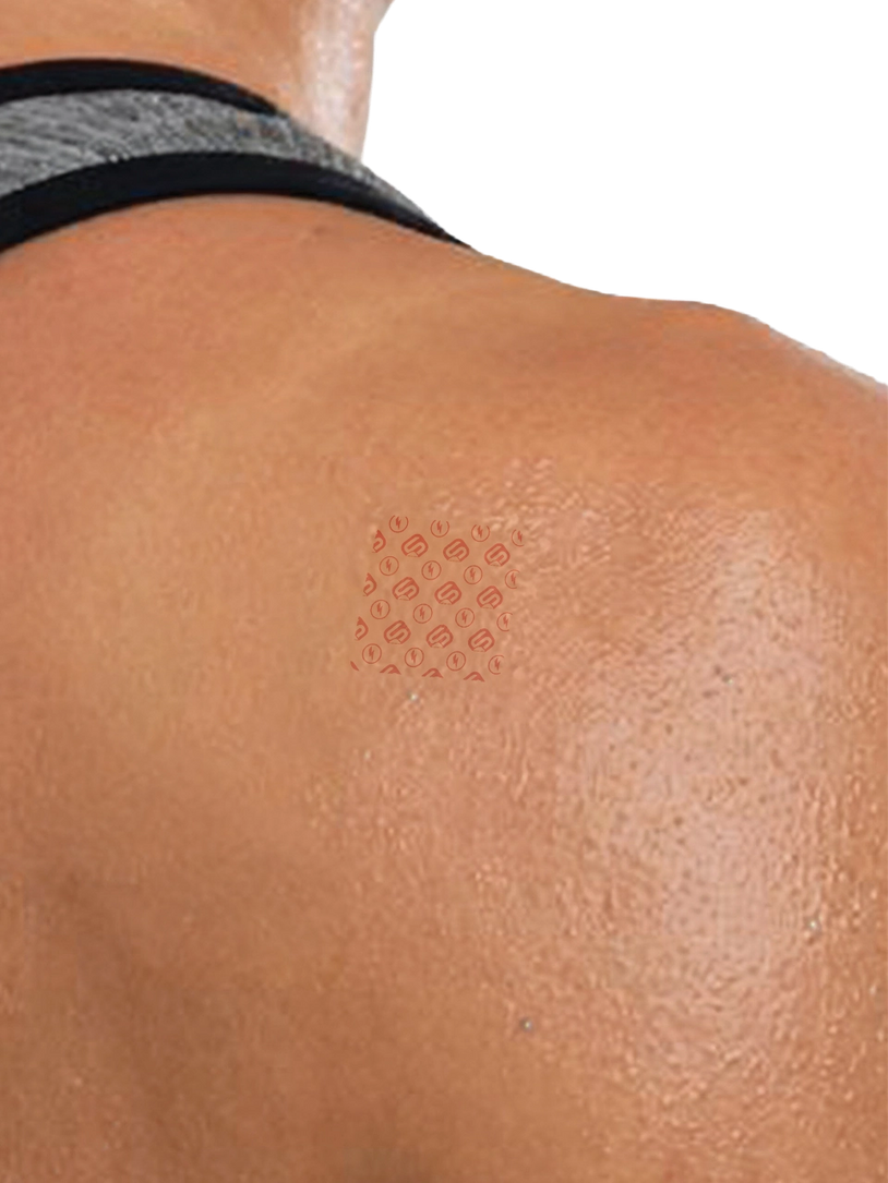 Parte superior de la espalda