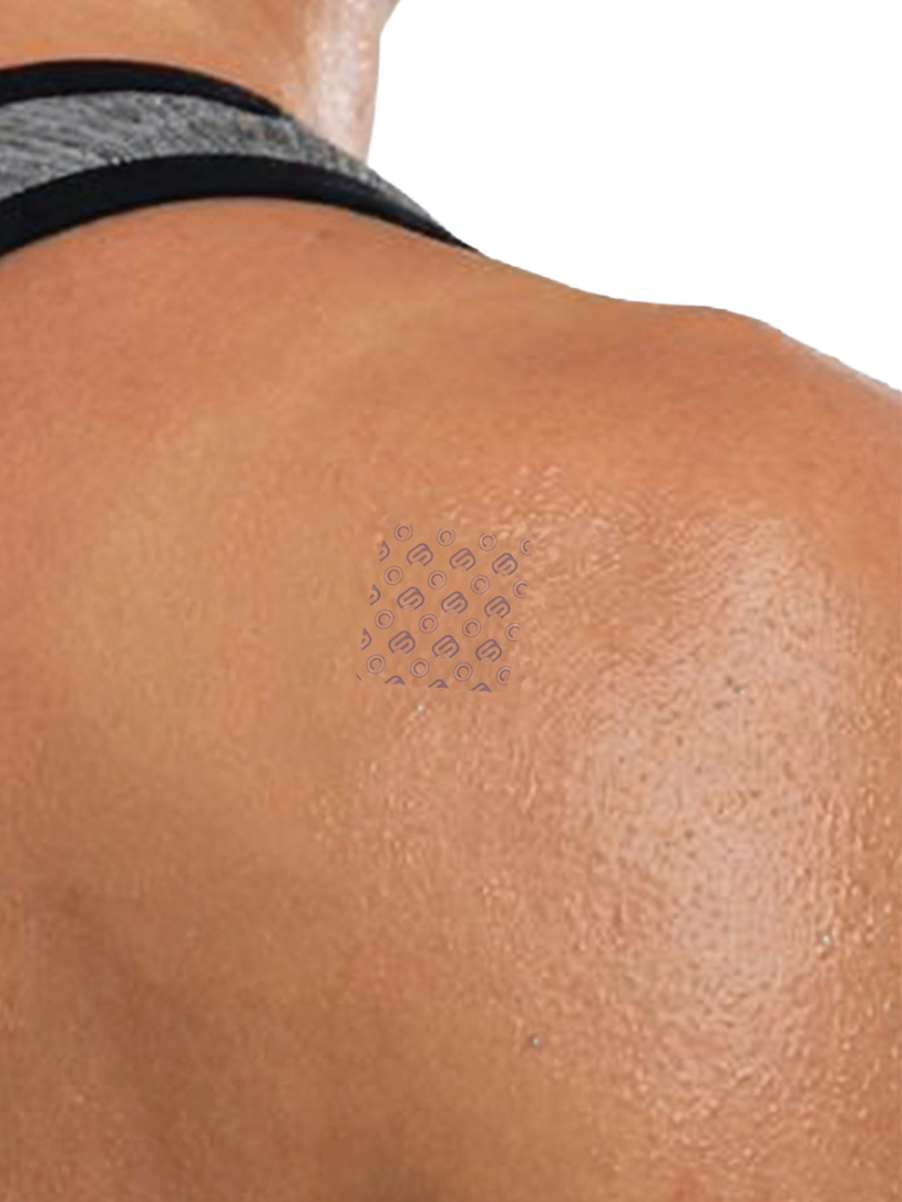 Upper Back